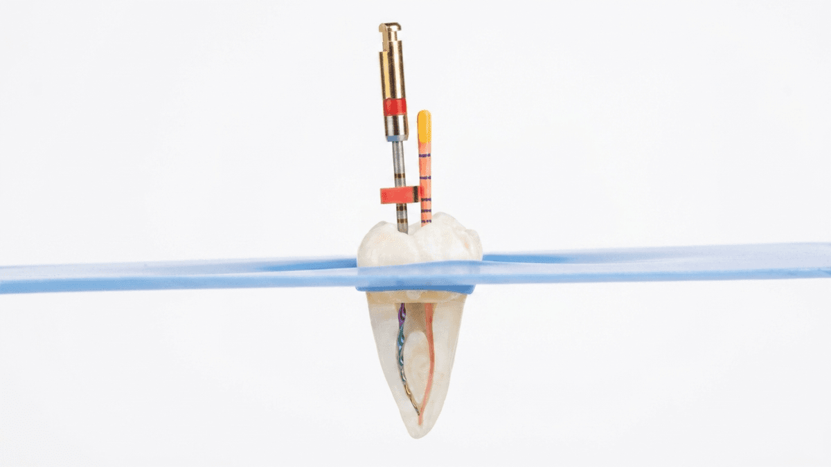 Root canal treatment procedure at Faisal's Dental Care Gulshan